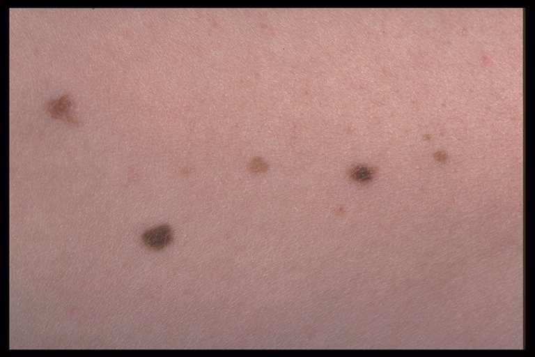 Dermatology Imagebank:...