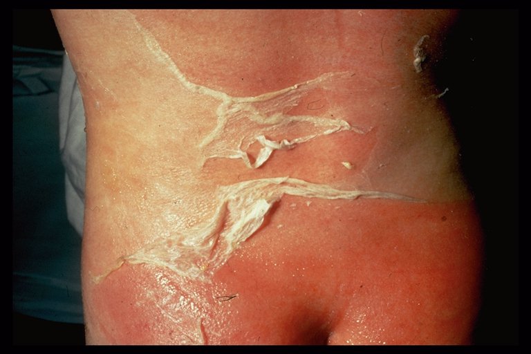 dermatology image