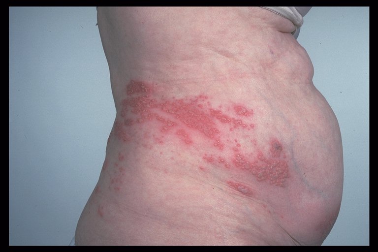 Causes of Forehead rash - RightDiagnosis.com